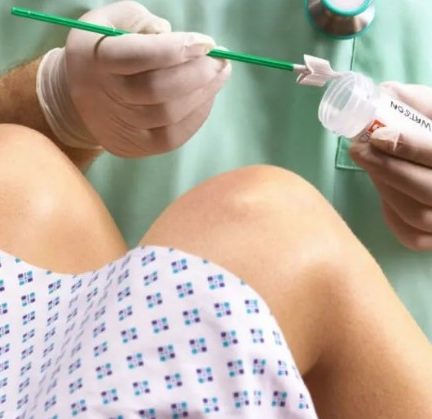 Мазок из матки при беременности: информационный гид для будущих мам