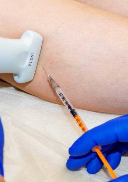 Склеротерапия в Минске: эффективность, особенности и ориентировочная стоимость процедуры