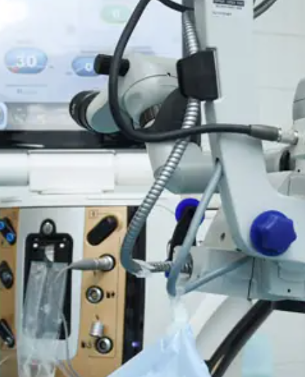 Как лечат глаукому с помощью лазерной терапии