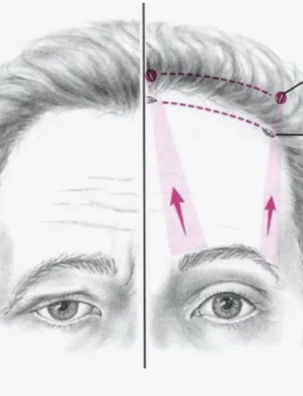 Онкоскрининг нервной системы: зачем проверяться, даже если ничего не беспокоит